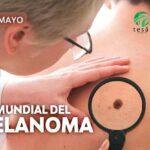 Fundación Tesãi celebra el Día Mundial contra el Melanoma